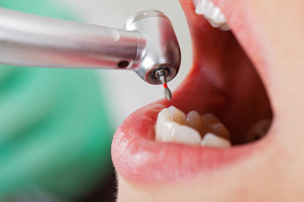 Best Emergency Dental Surgery in Weaverville, CA